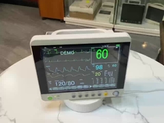 Multiparameter-Elektro-Patientenmonitor, medizinische Klinikausrüstung aus strapazierfähigem Kunststoff