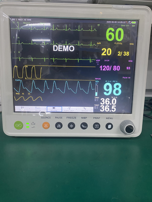 Tragbarer Patientenmonitor mit Parametern von ETCO2 ECG NIBP SPO2 RESP Temperatur-PR