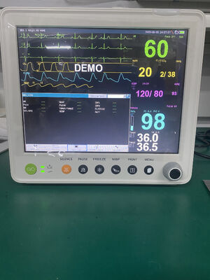 Tragbarer Multi-Parameter-Patientenmonitor mit 12,1" Farb-TFT-Display zur Überwachung der Vitalfunktionen