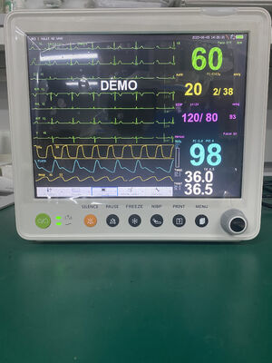 Tragbarer Multi-Parameter-Patientenmonitor mit 12,1" Farb-TFT-Display zur Überwachung der Vitalfunktionen