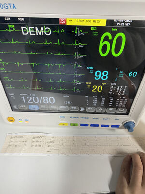 Tragbare Bettside-Monitor mit EKG SPO2 NIBP TEMP RESP Optional ETCO2-Klasse II 1-Jahresgarantie