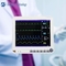 Krankenhaus-große Guss-multi Parameter-Patientenmonitor Vital Sign Monitoring 15 Zoll